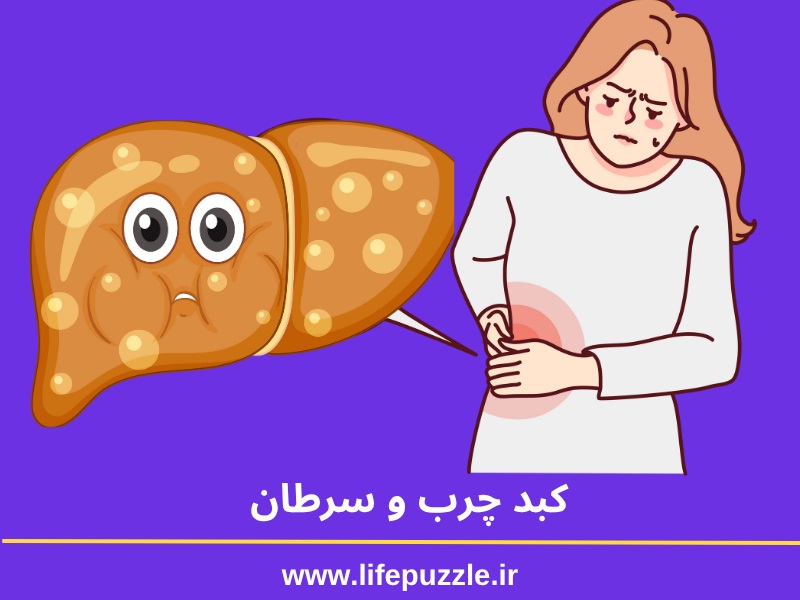 کبد چرب و سرطان